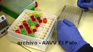 Lee más sobre el artículo ENCUESTA SERO-EPIDEMIOLÓGICA DE LA INFECCIÓN POR SARS-COV-2 EN ESPAÑA (ENE-COVID),INFORMACIÓN GENERAL.